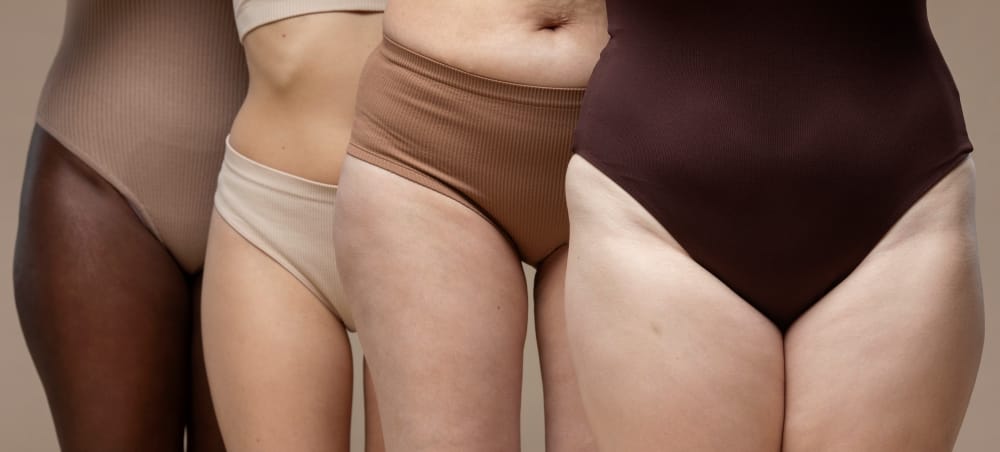 Lipedema nas pernas, entenda o que é mito e o que é verdade.